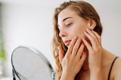 Vegan minerale foundation bij gevoelige huid - Mineralissima