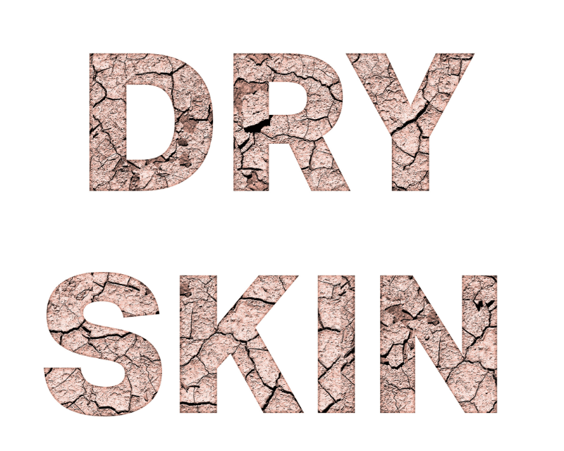 Dry skin